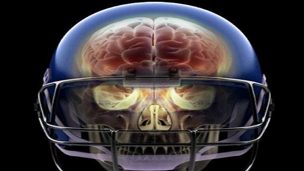 xray image skull with football helmet