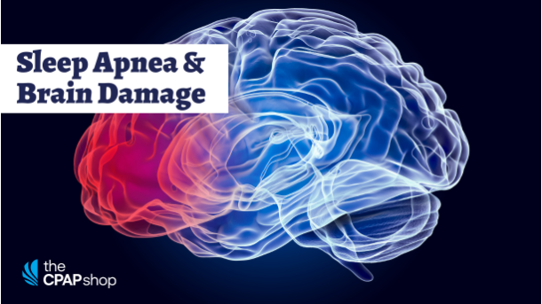 Can Sleep Apnea Cause Brain Damage?