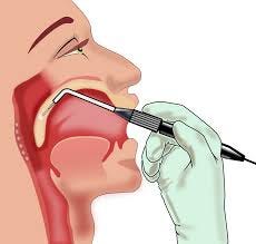 sleep apnea surgery changes the shape of your throat