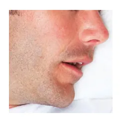 man breathing through mouth while sleeping